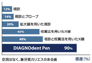 ダイアグノデントデータ