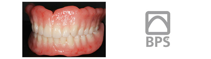 BPS義歯