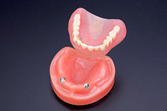 磁性アタッチメント義歯